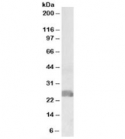 Western blot testing of human placenta lysate with CREB3L2 antibody at 1ug/ml. Predicted molecular weight: ~57/51/28kDa (isoforms 1/2/3).