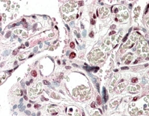 IHC staining of FFPE human placenta with CREB3L2 antibody at 5ug/ml. HIER: steamed with pH6 citrate buffer, AP-staining.~