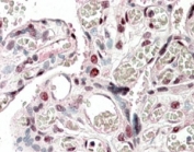 IHC staining of FFPE human placenta with CREB3L2 antibody at 5ug/ml. HIER: steamed with pH6 citrate buffer, AP-staining.