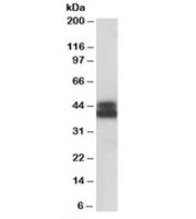 Western blot testing of Jurkat lysate with HLA-B antibody at 0.1ug/ml. Predicted molecular weight: ~40/45kDa (unmodified/glycosylated).