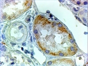 IHC testing of FFPE human kidney with AADAT antibody at 2ug/ml. HIER: steamed with pH6 citrate buffer, HRP-staining.
