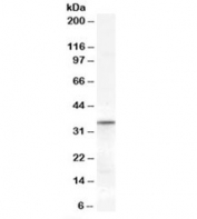 Western blot testing of human heart lysate with VDAC2 antibody at 0.3ug/ml. Predicted molecular weight: ~32kDa.