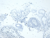 Negative control: IHC staining of FFPE human testis tissue without primary antibody. Required HIER: steamed antigen retrieval with pH6 citrate buffer; HRP-staining.