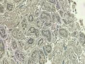 IHC staining of FFPE human testis tissue with LDHC antibody at 5ug/ml. Required HIER: steamed antigen retrieval with pH6 citrate buffer; HRP-staining.