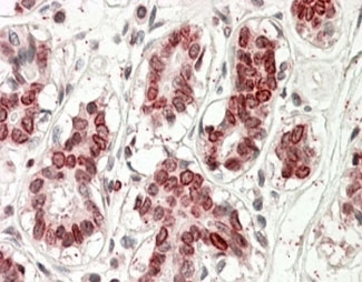 IHC staining of FFPE human breast with UBASH3A antibody at 4ug/ml. HIER: steamed with pH6 citrate buffer, AP-staining.