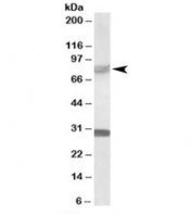 Western blot testing of rat brain lysate with TRIM2 antibody at 0.5ug/ml. Predicted molecular weight: ~81/84kDa (isoforms 1/2). All three observed bands are blocked by addition of the immunizing peptide.