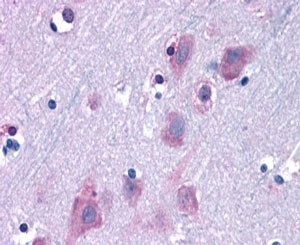 IHC staining of FFPE human cortex with TRIM2 antibody at 6.3ug/ml. HIER: steamed with pH6 citrate buffer, AP-staining.~