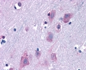 IHC staining of FFPE human cortex with TRIM2 antibody at 6.3ug/ml. HIER: steamed with pH6 citrate buffer, AP-staining.