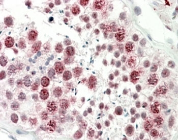 IHC testing of FFPE human testis with DNAJC5G antibody at 5ug/ml. HIER: steamed with pH6 citrate buffer, AP-staining.