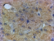 IHC testing of FFPE human liver with PEX13 antibody at 3ug/ml. HIER: steamed with pH6 citrate buffer, HRP-staining.