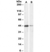 Western blot testing of human Jurkat [A] and mouse NIH3T3 [B] nuclear lysates with CREB antibody at 0.1ug/ml. Predicted molecular weight is 37kDa but routinely observed at ~43kDa.