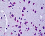 IHC testing of FFPE mouse brain tissue with Cyld antibody at 5ug/ml. Required HIER: steamed antigen retrieval with pH6 citrate buffer; AP-staining.