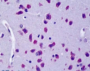 IHC testing of FFPE mouse brain tissue with Cyld antibody at 5ug/ml. Required HIER: steamed antigen