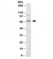 Western blot testing of human duodenum lysate with SNTG2 antibody at 0.3ug/ml. Predicted molecular weight: ~60kDa, observed here at ~70kDa.