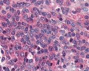 IHC testing of FFPE human spleen tissue with PTGER1 antibody at 5ug/ml. Required HIER: steamed antigen retrieval with pH6 citrate buffer; AP-staining.