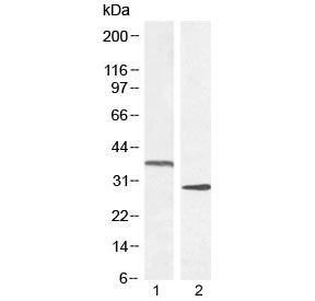Western blot testing of 1) rat adipose and 2) mouse spleen lysate with UCP2 antibody at 1ug/ml. Predicted molecular weight ~34