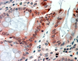 IHC testing of FFPE human colon with FIZZ1 antibody at 2.5ug/ml. HIER: steamed with pH6 citrate buffer, AP-staining.