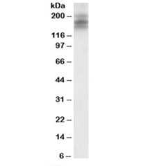 Western blot testing of human cerebellum lysate with DSCAM antibody at 2ug/ml. Predicted molecular weight: ~174kDa.