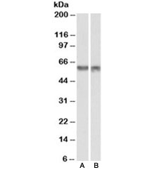 Western blot testing of nuclear mouse NIH3T3 [A] and nuclear human HeLa [B] lysates with PDCD4 antibody at 1ug/ml. Predicted molecular weight ~50kDa, observed here at ~60kDa.