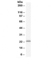 Western blot testing of human liver lysate with RBP4 antibody at 0.3ug/ml. Predicted molecular weight: ~23kDa.
