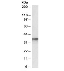 Western blot testing of MCF7 lysate with HNRNPA2B1 antibody at 0.3ug/ml. Predicted molecular weight: ~36kDa.