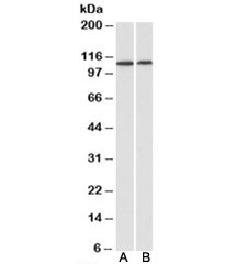 Western blot testing of human heart [A] and kidney [B] lysates with BMP antibody at 1ug/ml. Predicted molecular weight: ~111kDa.