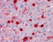 IHC staining of FFPE human liver with S100A9 antibody at 2.5ug/ml. HIER: steamed with pH6 citrate buffer, AP-staining.