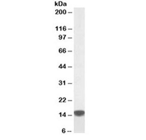 Western blot testing of human peripheral mononucleocytes lysate with S100A9 antibody at 0.5ug/ml. Predicted molecular weight ~13kDa, routinely observed at ~16kDa.