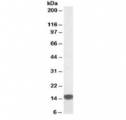 Western blot testing of human peripheral mononucleocytes lysate with S100A9 antibody at 0.5ug/ml. Predicted molecular weight ~13 kDa, routinely observed at 13~16 kDa.