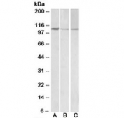 Western blot of NIH3T3 (A), mouse brain (B) and rat brain (C) lysates with MTHFD1L antibody at 0.1ug/ml. Predicted molecular weight: ~106 kDa.