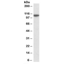 Western blot testing of human cerebellum lysate with MTHFD1L antibody at 0.1ug/ml. Predicted molecular weight: ~106kDa.