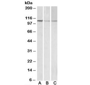 Western blot of NIH3T3 (A), mouse brain (B) and rat brain (C) lysates with MTHFD1L antibody at 0.1ug/ml. Predicted molecular weight: ~106kDa.