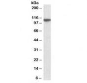 Western blot testing of human cerebellum lysate with MTHFD1L antibody at 0.1ug/ml. Predicted molecular weight: ~106 kDa.