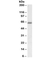 Western blot testing of MOLT4 lysate with IKZF1 antibody at 1ug/ml. Predicted molecular weight ~58kDa but routinely observed at ~65kDa.~