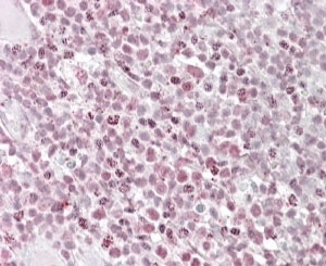 IHC staining of FFPE human tonsil with IKZF1 antibody at 4ug/ml. HIER: steamed with pH6 citrate bu