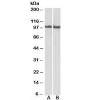 Western blot testing of mouse [A] and rat [B] skeletal muscle lysate with CLOCK antibody at 0.03ug/ml. Predicted molecular weight ~95 kDa but routinely observed at 95-110 kDa.