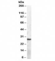 Western blot testing of mouse spleen lysate with APOBEC1 antibody at 1ug/ml. Predicted molecular weight: ~28kDa.