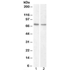 Western blot testing of human 1) HeLa and 2) Jurkat nuclear fraction lysate with Lamin B1 antibody at 1ug/ml. Predicted molecular weight ~66 kDa.~