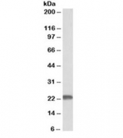 Western blot testing of human cerebellum lysate with MNSOD antibody at 0.01ug/ml. Predicted molecular weight ~ 25 kDa.