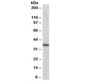Western blot testing of A431 lysate with PDLIM4 antibody at 0.2ug/ml. Predicted molecular weight: ~35kDa.~