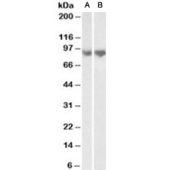 Western blot of mouse lung (A) and rat lung (B) lysates with E-Cadherin antibody at 0.3ug/ml. Expected molecular weight: 135 kDa (precursor), 80-120 kDa (mature, depending on gylcosylation level).