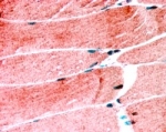 IHC testing of FFPE human skeletal muscle with MURF1 antibody at 1.25ug/ml. HIER: steamed with pH6 citrate buffer, AP-staining.