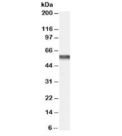 Western blot testing of human bone marrow lysate with CACNB4 antibody at 0.2ug/ml. Predicted molecular weight: ~58/55/56kDa (isoforms a/b/c).