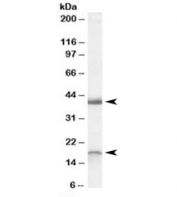 Western blot testing of rat brain lysate with Ramp1 antibody at 0.3ug/ml. Routinely observed at ~18kDa and 40kDa.