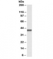 Western blot testing of human breast cancer lysate with CXCR1 antibody at 0.3ug/ml. Predicted molecular weight ~40kDa.