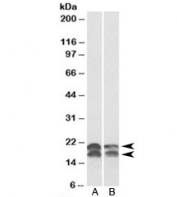 Western blot testing of A549 [A] and HeLa [B] lysates with NME1 antibody at 0.01ug/ml. Predicted molecular weight: ~20/17kDa (isoforms a/b).