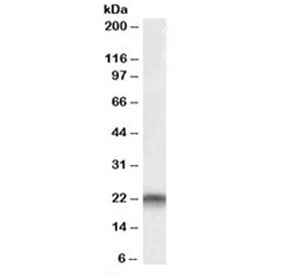 Western blot testing of A549 lysate with PEBP1 antibody at 0.01ug/ml. Predicted molecular weight: ~21kDa.