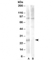 Western blot testing of human heart lysate with APOBEC2 antibody at 1ug/ml with [B] and without [A] blocking peptide. Predicted molecular weight: ~26kDa.