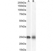 Western blot testing of A) rat heart and 2) rat brain tissue lysate with NDUFS8 antibody. Predicted molecular weight: ~24kDa.