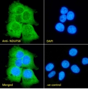IF/ICC staining of fixed and permeabilized human A431 cells with NDUFS8 antibody (green) at 10ug/ml and DAPI nuclear stain (blue).